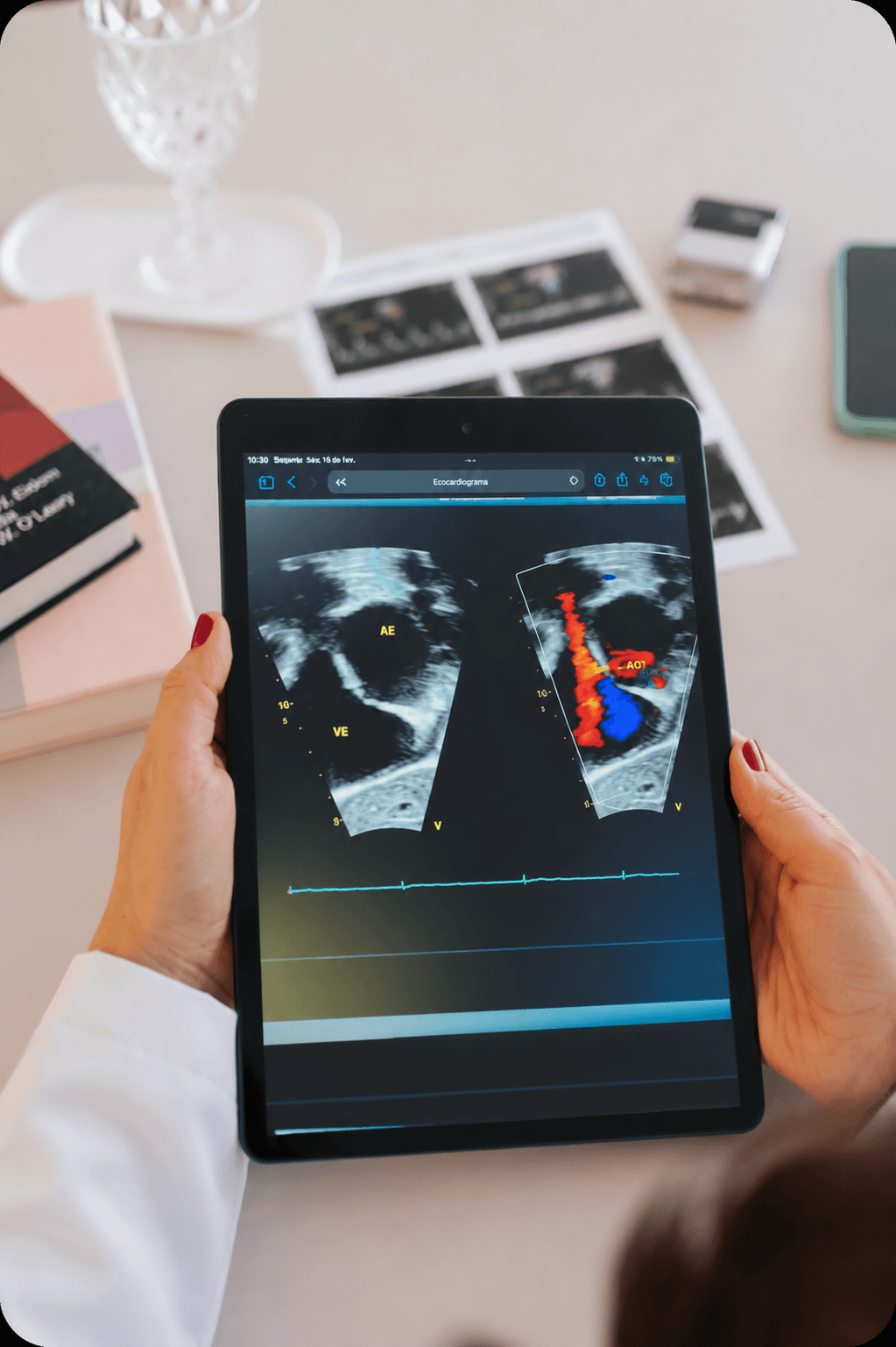 Tablet exibindo as imagens de um ecocardiograma, uma delas com o Doppler colorido, sobre a mesa ao lado do laudo impresso.